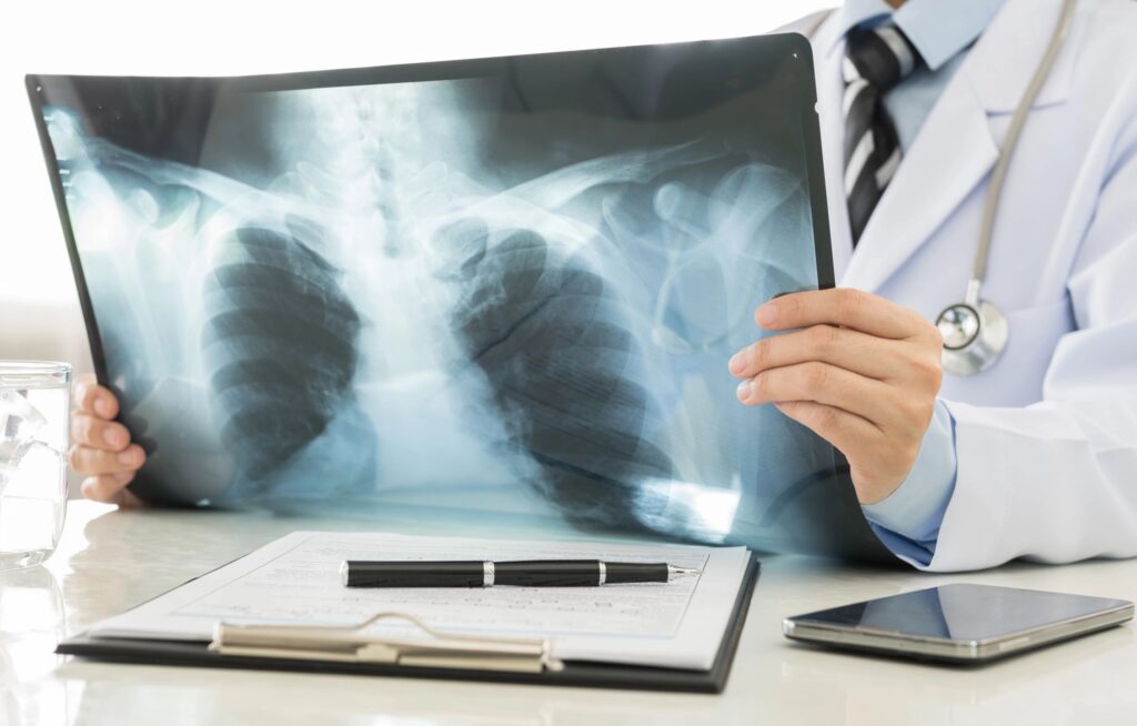 Tuberculosis FAQ - Provider Resources WA